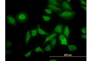 Immunofluorescence of monoclonal antibody to PDIA5 on HeLa cell. (PDIA5 anticorps  (AA 31-130))