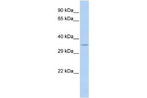 WB Suggested Anti-SPDYA Antibody Titration: 0. (SPDYA anticorps  (N-Term))