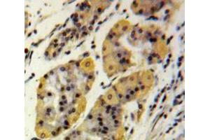 IHC-P analysis of Stomach tissue, with DAB staining. (MMP2 anticorps  (AA 110-660))