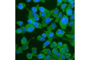 IF analysis of YTHDF2 using anti-YTHDF2 antibody (ABIN7603191). (YTHDF2 anticorps  (N-Term))