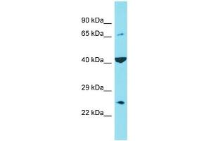 Host: Rabbit Target Name: C6orf120 Sample Type: Hela Whole cell lysates Antibody Dilution: 1.