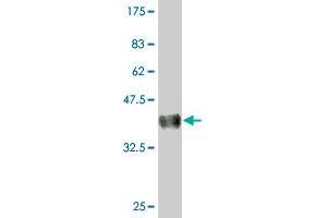 Western Blot detection against Immunogen (36. (AMPD2 anticorps  (AA 86-185))