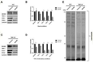 AICAR suppresses ECM proteins in primary human TM cells under basal and TGF-β2 stimulatory conditions.