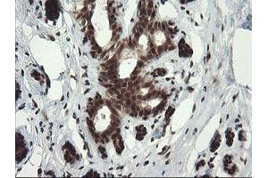 Image no. 1 for anti-Replication Factor C (Activator 1) 2, 40kDa (RFC2) (AA 1-234) antibody (ABIN1490617)