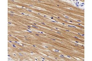Immunohistochemistry analysis of paraffin-embedded rat heart using TNNT2 Polyclonal Antibody at dilution of 1:200. (Cardiac Troponin T2 anticorps)