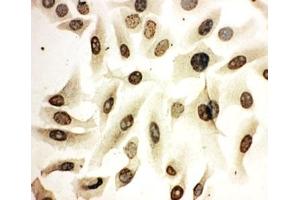 ICC testing of HeLa cells (HOXA4 anticorps  (N-Term))