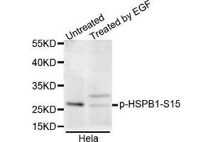 Western blot analysis of extracts of various cell lines, using Phospho-HSPB1-S15 antibody. (HSP27 anticorps  (pSer15))