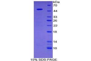 SDS-PAGE analysis of Human GAL3ST1 Protein.