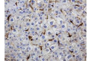 Image no. 5 for anti-Thymidine Phosphorylase (TYMP) (AA 311-482) antibody (ABIN1491396)