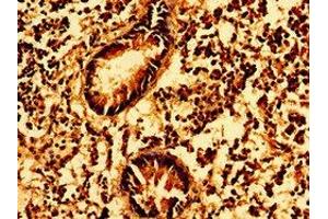 Immunohistochemistry of paraffin-embedded human appendix tissue using ABIN7154565 at dilution of 1:100
