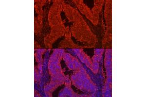 Immunofluorescence analysis of human colon carcinoma using LG Rabbit pAb (ABIN7268200) at dilution of 1:100 (40x lens). (Galectin 2 anticorps  (AA 1-132))