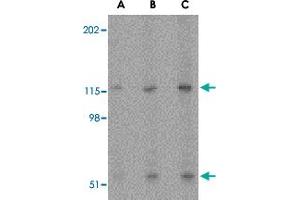 Western blot analysis of PRSS12 in SK-N-SH cell lysate with PRSS12 polyclonal antibody  at (A) 0.