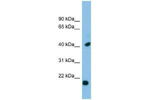 HSPB2 antibody used at 1 ug/ml to detect target protein. (HSPB2 anticorps  (Middle Region))