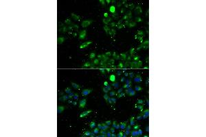 Immunofluorescence analysis of U2OS cell using UQCRFS1 antibody. (UQCRFS1 anticorps)