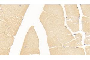 Detection of ALT in Human Skeletal muscle Tissue using Monoclonal Antibody to Alanine Aminotransferase (ALT)