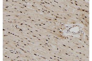 ABIN6279782 at 1/100 staining Rat heart tissue by IHC-P. (RPS6KL1 anticorps  (Internal Region))