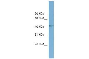 AMDHD1 antibody used at 1 ug/ml to detect target protein. (AMDHD1 anticorps  (N-Term))