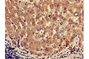 Immunohistochemistry of paraffin-embedded human liver tissue using ABIN7162423 at dilution of 1:100
