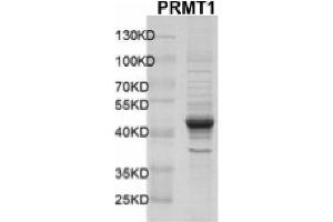 Recombinant PRMT1 protein gel.