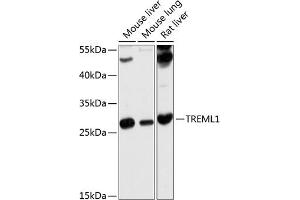 Western blot analysis of extracts of various cell lines, using TREML1 antibody (ABIN6129498, ABIN6149484, ABIN6149485 and ABIN6214659) at 1:1000 dilution. (TREML1 anticorps  (AA 16-162))