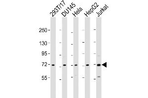 All lanes : Anti-ZFP64 Antibody (C-Term) at 1:2000 dilution Lane 1: 293T/17 whole cell lysate Lane 2: D whole cell lysate Lane 3: Hela whole cell lysate Lane 4: HepG2 whole cell lysate Lane 5: Jurkat whole cell lysate Lysates/proteins at 20 μg per lane. (ZFP64 anticorps  (AA 244-279))