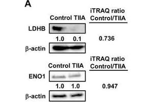 Treatment with TIIA changes the expression of glucose metabolism-related proteins in AGS cells.