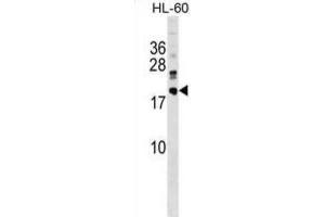 Western Blotting (WB) image for anti-DnaJ (Hsp40) Homolog, Subfamily C, Member 30 (DNAJC30) antibody (ABIN5019514) (DNAJC30 anticorps)