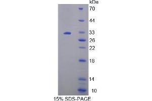 Image no. 1 for AMP Activated Protein Kinase Alpha2 (AA 252-493) protein (His tag) (ABIN6238097)