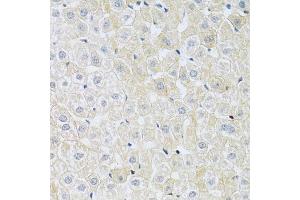 Immunohistochemistry of paraffin-embedded rat liver using SLC4 antibody (ABIN6132890, ABIN6148015, ABIN6148016 and ABIN6214688) at dilution of 1:100 (40x lens). (NBC4 anticorps  (AA 1042-1121))