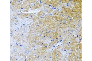 Immunohistochemistry of paraffin-embedded Mouse heart using BMP3 Polyclonal Antibody at dilution of 1:100 (40x lens). (BMP3 anticorps)