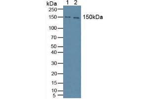 Western blot analysis of (1) Mouse Brain Tissue and (2) Human HeLa cells.