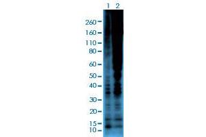 Western blot analysis of Lane 1: serum-starved A431 cells, Lane 2: serum-starved A431 cells treated with Calyculin A/Okadaic Acid using Phosphothreonine monoclonal antibody, clone RM102  at 1:2000 dilution. (Phosphothreonine anticorps)