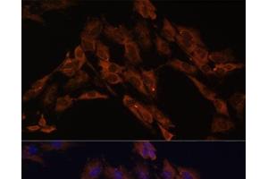 anti-Ecto-NOX Disulfide-Thiol Exchanger 2 (ENOX2) antibody