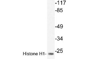 Western blot (WB) analyzes of Histone H1oo antibody in extracts from HUVEC cells. (Histone H1 anticorps)