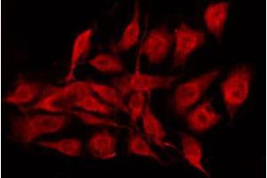 ABIN6267352 staining MCF7 by IF/ICC.