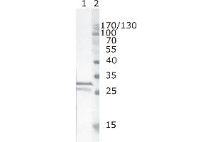 Western Blot testing of HIV-1 recombinant Nef protein. (HIV-1 Nef (AA 35-50) anticorps)