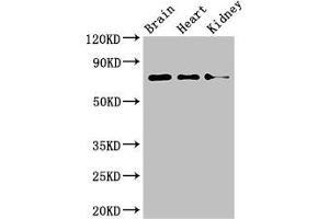 Western Blot Positive WB detected in: Mouse brain tissue, Mouse heart tissue, Mouse kidney tissue All lanes: PDIA4 antibody at 4 μg/mL Secondary Goat polyclonal to rabbit IgG at 1/50000 dilution Predicted band size: 73 kDa Observed band size: 73 kDa (PDIA4 anticorps  (AA 101-400))