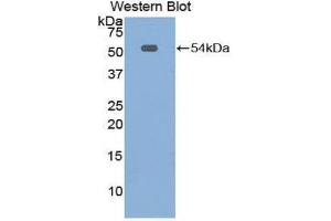 Western Blotting (WB) image for anti-Mesothelin (MSLN) (AA 400-615) antibody (ABIN1859885) (Mesothelin anticorps  (AA 400-615))