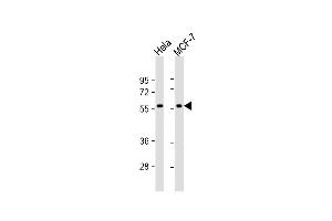 Western Blot at 1:1000 dilution Lane 1: Hela whole cell lysate Lane 2: MCF-7 whole cell lysate Lysates/proteins at 20 ug per lane. (TIGD1 anticorps  (N-Term))