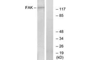 Western blot analysis of extracts from HeLa cells, treated with Serum, using FAK (Ab-861) Antibody. (FAK anticorps  (AA 828-877))