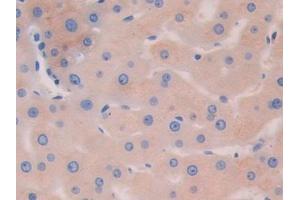 Detection of HEXb in Human Liver Tissue using Polyclonal Antibody to Hexosaminidase B Beta (HEXb) (HEXB anticorps  (AA 122-311))