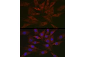 Immunofluorescence analysis of NIH/3T3 cells using DNPH1 Rabbit mAb (ABIN7266383) at dilution of 1:50 (40x lens). (RCL anticorps)