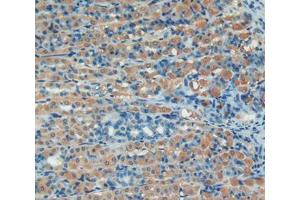 IHC-P analysis of stomach tissue, with DAB staining. (SERPING1 anticorps  (AA 148-270))