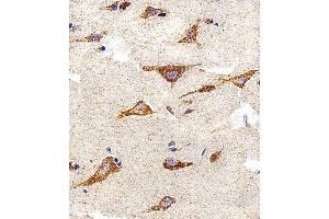 Immunohistochemical analysis of paraffin-embedded H. (IDH3B anticorps  (N-Term))
