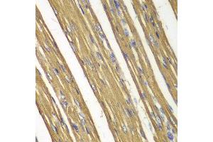 Immunohistochemistry of paraffin-embedded rat heart using Casp7 antibody at dilution of 1:100 (400x lens).