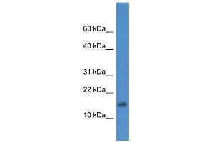 WB Suggested Anti-XAGE2 Antibody Titration: 0. (XAGE2 anticorps  (Middle Region))