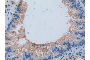 Detection of IL17RA in Mouse Lung Tissue using Polyclonal Antibody to Interleukin 17 Receptor A (IL17RA) (IL17RA anticorps  (AA 590-848))