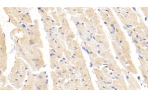 Detection of SOD1 in Rabbit Cardiac Muscle Tissue using Polyclonal Antibody to Superoxide Dismutase 1 (SOD1)
