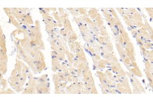 Detection of SOD1 in Rabbit Cardiac Muscle Tissue using Polyclonal Antibody to Superoxide Dismutase 1 (SOD1) (SOD1 anticorps  (AA 2-153))
