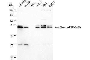 Western blotting analysis using Phospho-PKR (T451) antibody (ABIN7798509).